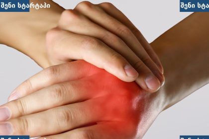 ხელზე ტკივილის სიმპტომები, საქართველო